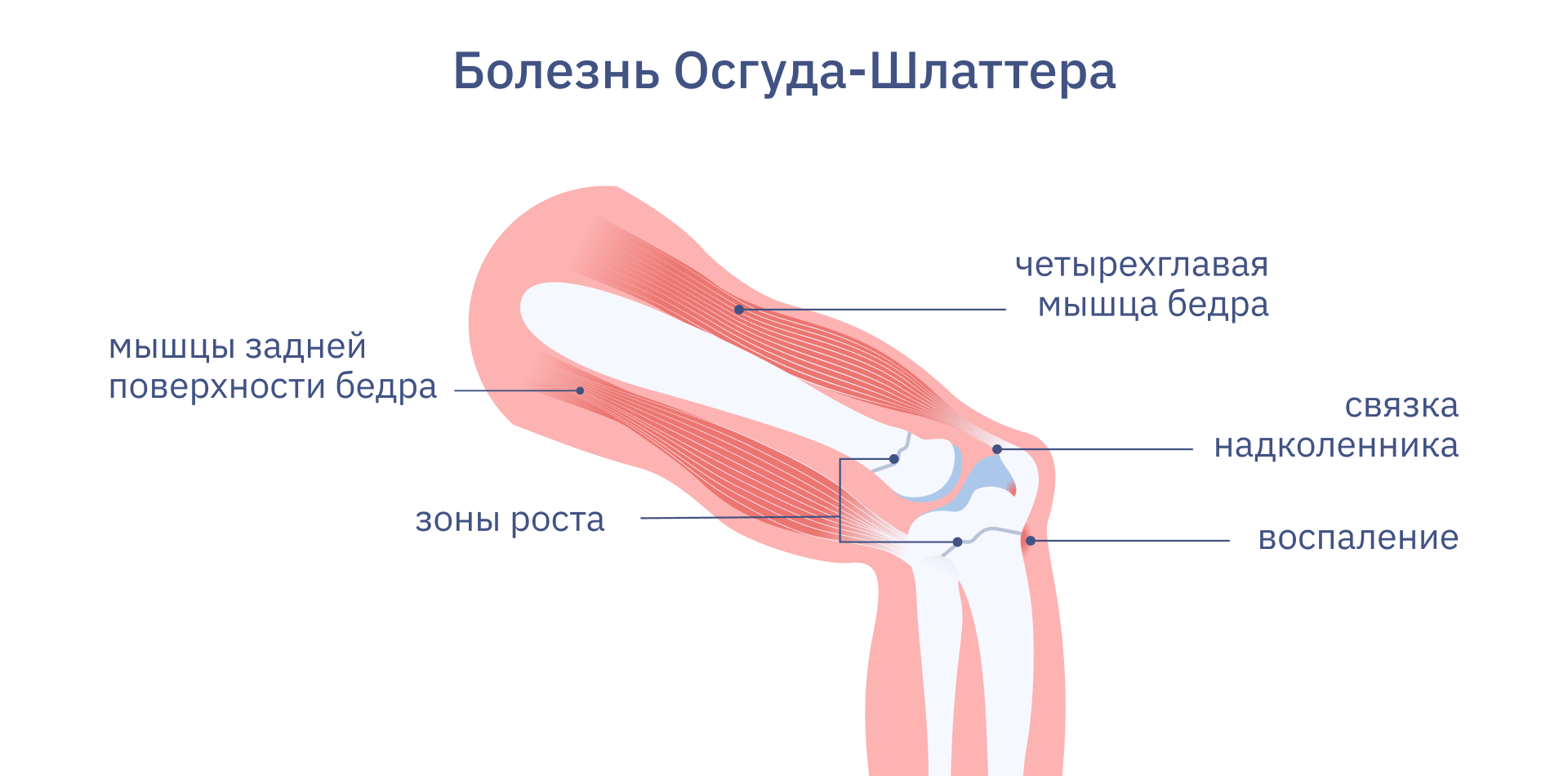 Болезнь Шляттера Фото