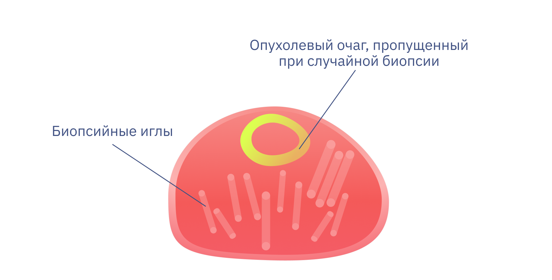 Биопсия Простаты Стоимость Москва К31